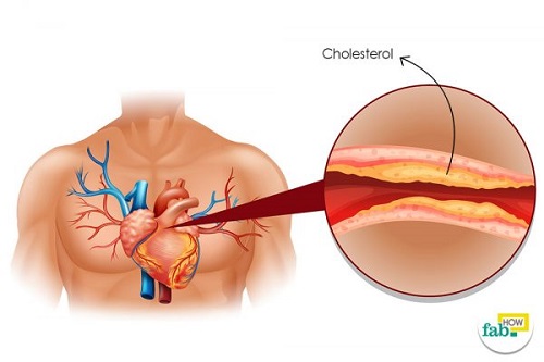 Reduce your Bad Cholesterol Level Naturally